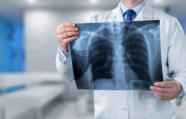 Diagnóstico por Imagem em Curitiba: A imagem mostra um médico segurando com ambas as mãos e analisando o resultado de uma radiografia realizada na região torácica do paciente.
