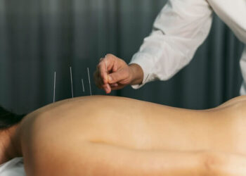 Benefícios da acupuntura para a saúde | Incórpore Centro Médico