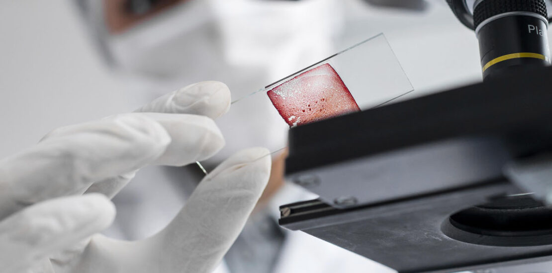 Alterações hormonais